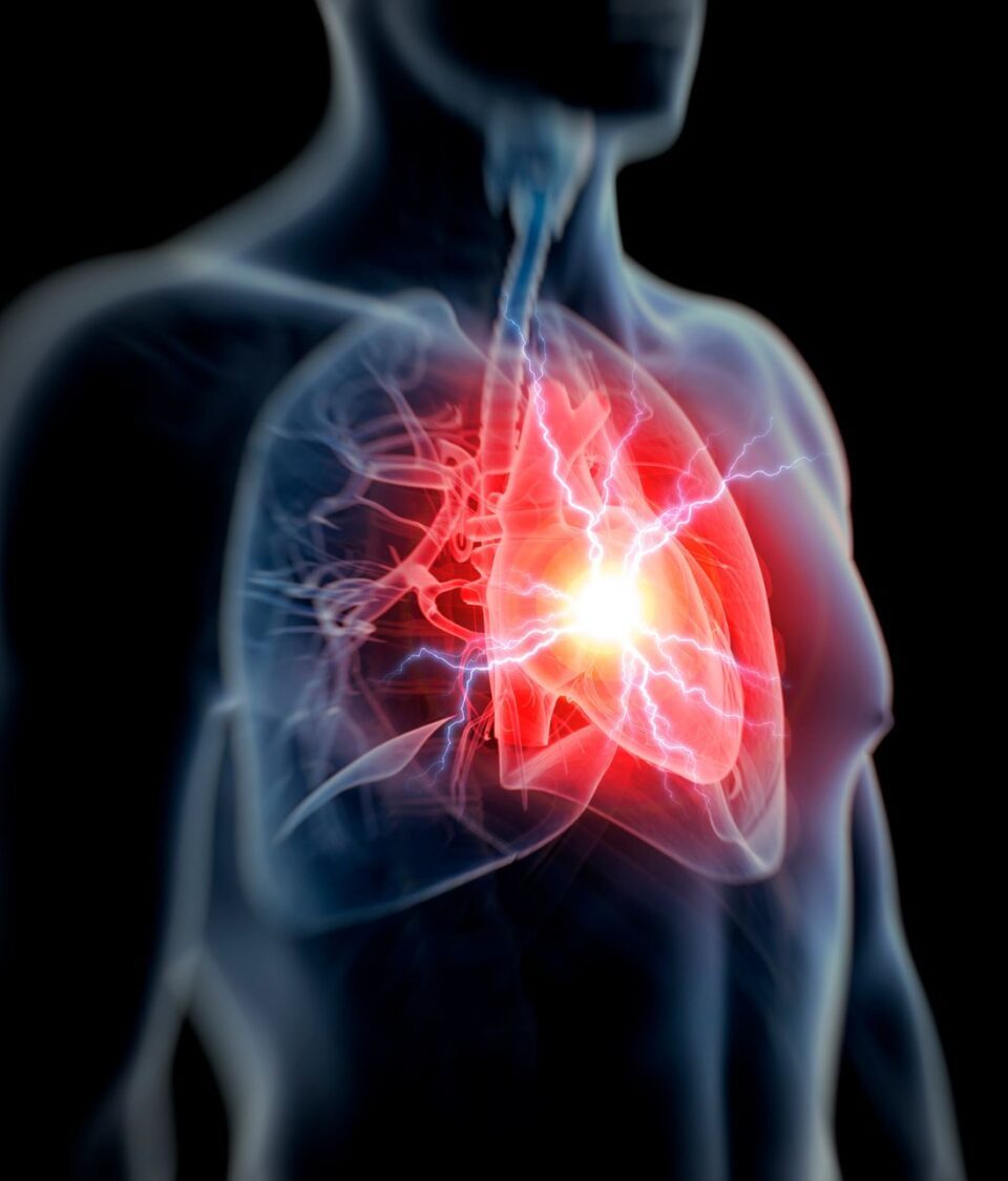 Am I Having A Heart Attack: 5 Things To Know